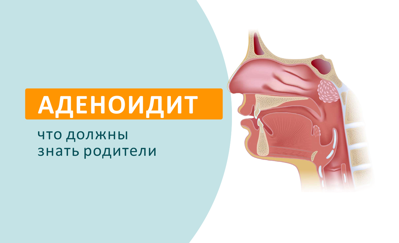 Что должен знать каждый родитель об аденоидите?